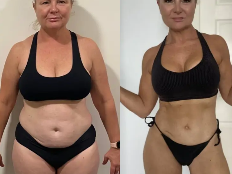 Antes y después